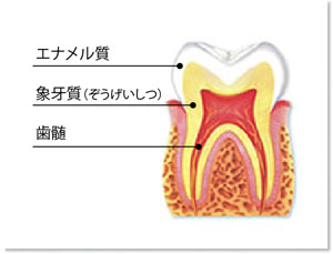 根幹治療イラスト